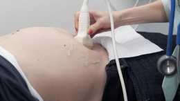 胎兒“臍帶繞頸”風險大？孕媽規避這3件事，能降低臍帶繞頸機率