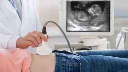怕孕期B超有輻射、做多了影響寶寶？真相在這裡