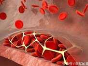 血管“清道夫”被找到了，每天吃一點，可養護血管，預防血栓