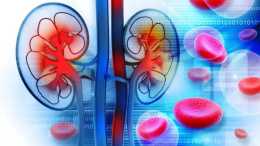 臨床案例, 幹細胞療法有助於在腎移植情況下改善腎功能