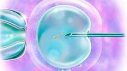 試管嬰兒怎麼取卵子和精子？